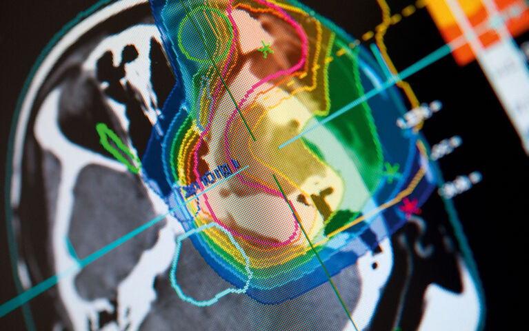 Heidelberg Ion Beam Therapy Center HIT