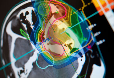 Heidelberg Ion Beam Therapy Center HIT