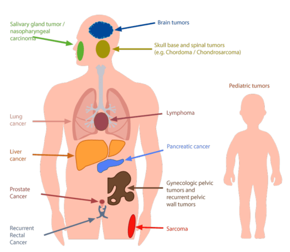 Indications treated at HIT English