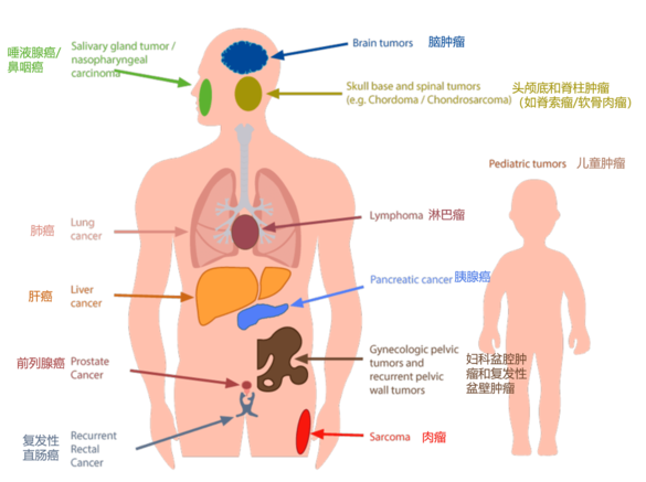 Proton Carbon Ion Treatment_Indications_chinese